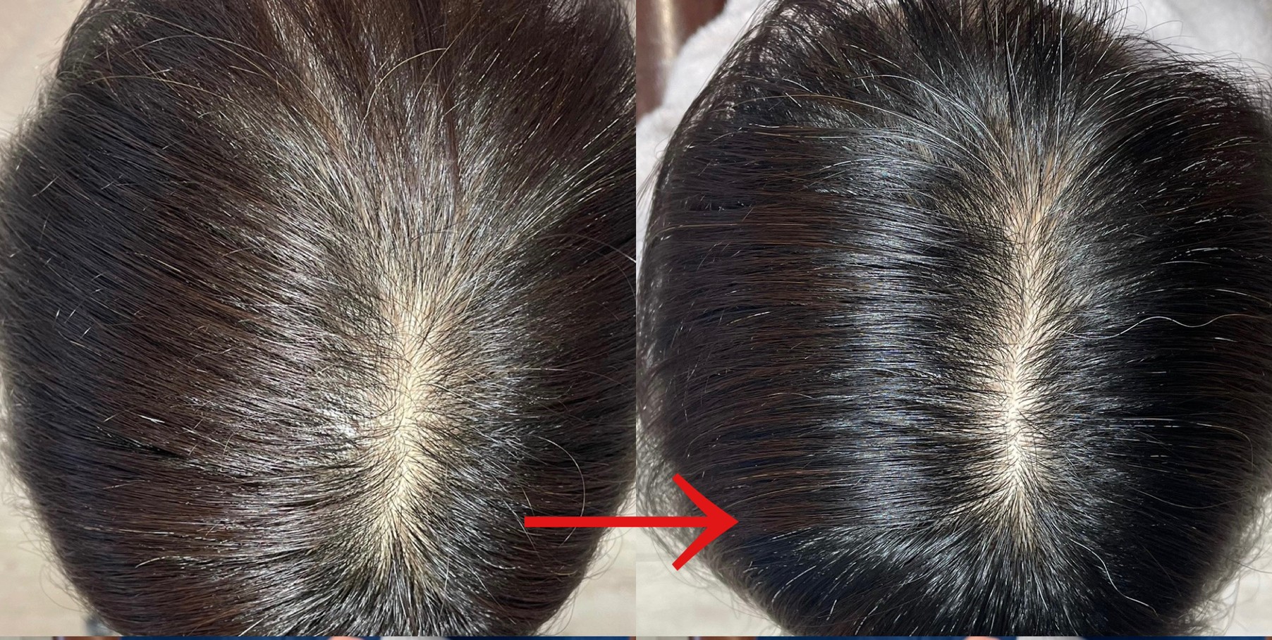 特価のおすすめ みきゃん様専用 ヘアキュア Hair Cure infokomscience